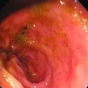 Approach to Chronic Diarrhoea in companion animals