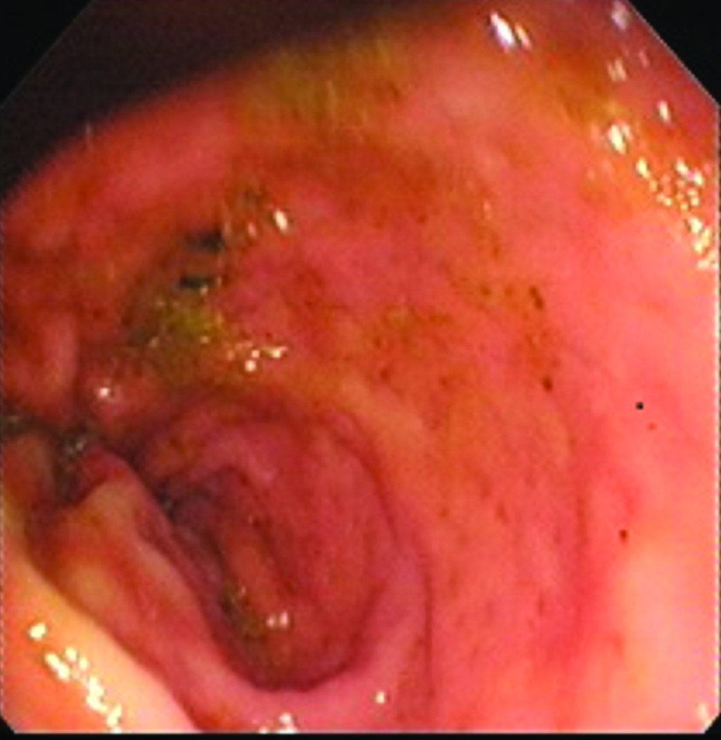 Approach to Chronic Diarrhoea in companion animals