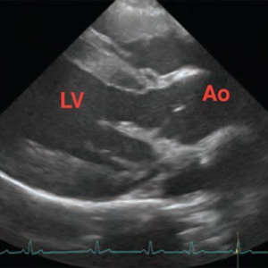 Cardiac Auscultation