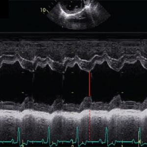 Dilated cardiomyopathy in dogs – what’s new?
