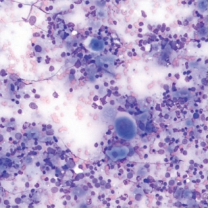 Cytology of the Lymphoid System – Case Studies