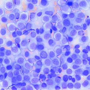 Canine histiocytoma, histiocytosis or histiocytic sarcoma; what happens when histiocytes go wrong?*