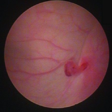 Diagnosis and management of canine idiopathic renal haematuria*