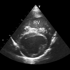 The collapsing dog: a cardiologist's viewpoint