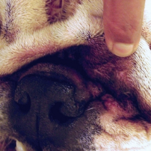 Malassezia Dermatitis - Diagnosis and Management