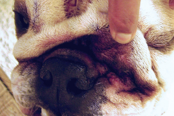 Malassezia Dermatitis - Diagnosis and Management