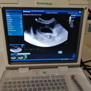 Point of Care Ultrasound