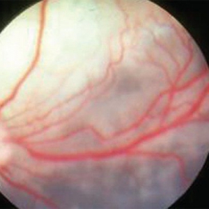 Understanding uveitis in the canine and feline eye*