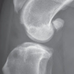 Canine Cruciate Disease – Aetiology and Diagnosis*