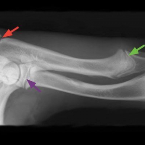 Elbow dysplasia part 1– definition and aetiology*