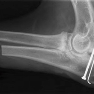 Elbow dysplasia Part 3 – treatment*