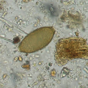 Feline lungworm infection: under diagnosed at home and abroad?