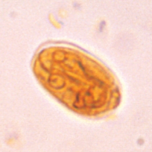 Giardia and Tritrichomonas: Incidental Findings or Significant Gut Pathogens?*