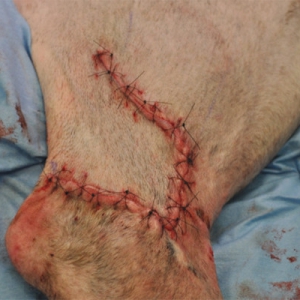 Decision making in wound management and closure*