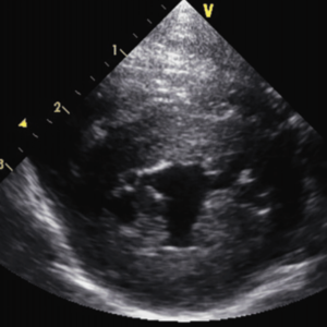 HCM and Copycats: Differential diagnoses of left ventricular thickening in cats