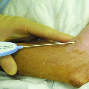 Soft Tissue Sarcomas in Dogs