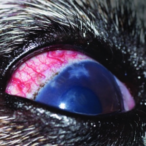 Clinical decisions: Glaucoma