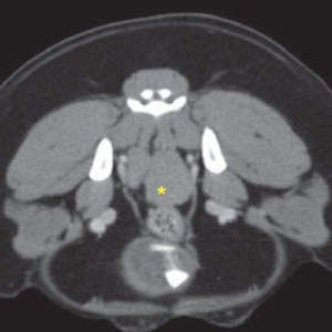 *Diagnosis and management of canine anal sac adenocarcinoma*