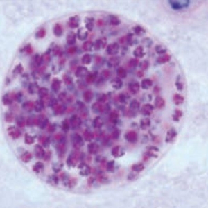 Toxoplasma and Neospora: Opposite sides of the same coin*
