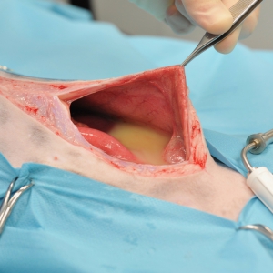 Abdominal Surgery – Part 1