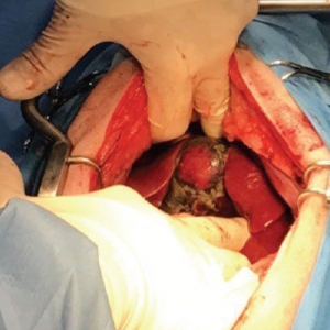 Biliary surgery in the dog and cat*