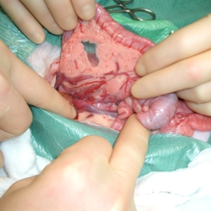 Abdominal Surgery – Part 2