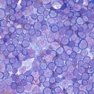 Cytology of the Lymphoid System