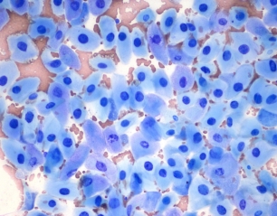 Skin Cytology for General Practice