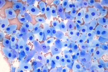 Skin Cytology for General Practice