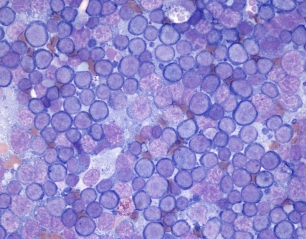 Cytology of the Lymphoid System