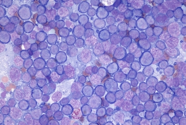 Cytology of the Lymphoid System