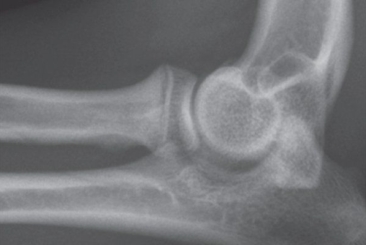 Hip and Elbow Dysplasia in Dogs