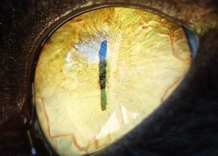 Ophthalmology