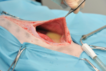 Abdominal Surgery – Part 1