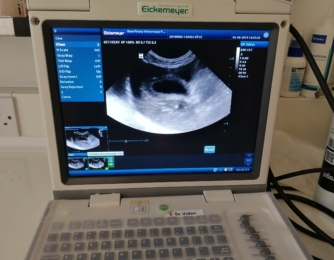 Point of Care Ultrasound