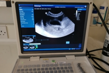Point of Care Ultrasound