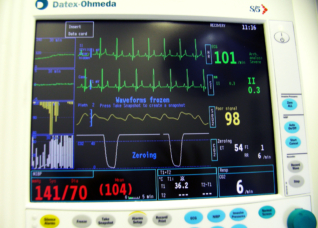 Anaesthesia