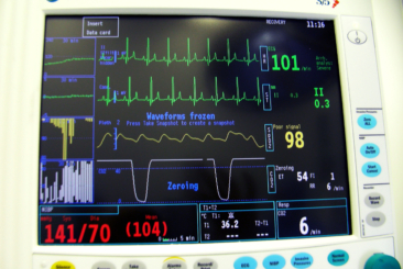 Anaesthetic Monitoring