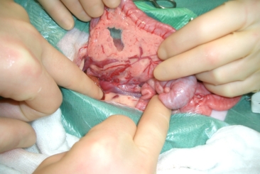Abdominal Surgery – Part 2