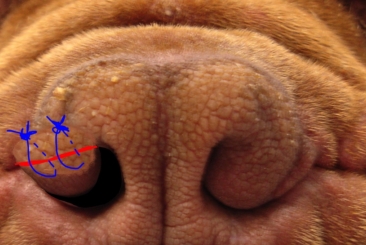 Head and Neck Surgery